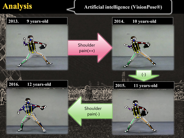 VisionPoseを選択した理由